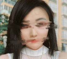 眼角处的小细纹已经不见了