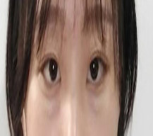 手术前自述