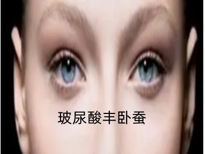 玻尿酸丰卧蚕