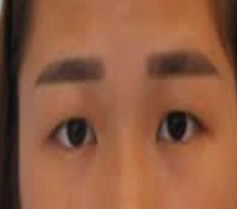 做了眼综合的我颜值都变好了
