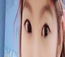想做双眼皮了