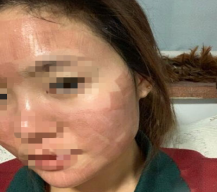 想要做美容