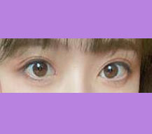 双眼皮手术宽度都很适合我