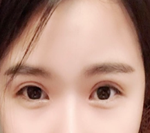 自己感觉恢复的挺快的