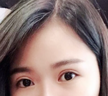 眼睛对称的感觉太好了