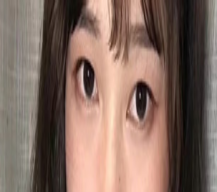 就想拥有双眼皮