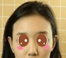 想做隆鼻手术来改善自己