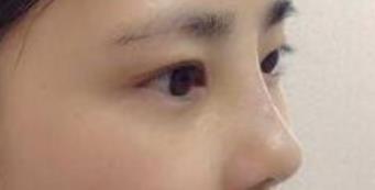 在变美的手术中