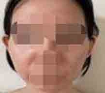因为脸很宽，显得很方，所以我去医院看看有没有什么办法能够改善