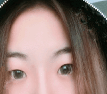 双眼皮的线条很适合我，眼型好看，看着精神