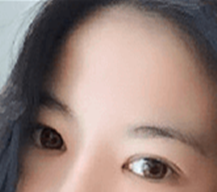 做完了双眼皮整个人的气质也变了