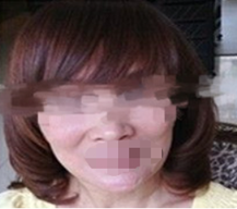 做了电波拉皮的现在都被人认成女儿的姐姐