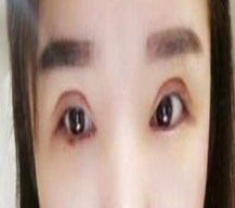 快速咯