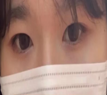 不想在贴双眼皮了