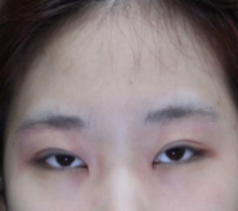 改善自己的死鱼眼，走起来