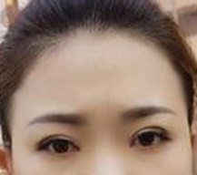 我的眼睛就已经恢复好啦