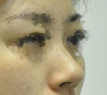 新鼻子让我五官都变得立体了起来