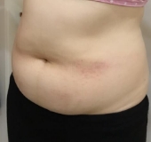 肚子的赘肉很多