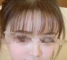 苹果肌特别饱满，很是好看