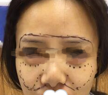 我也想拥有好看的瘦瘦的小脸