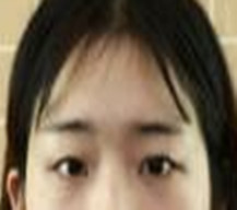 眼睛恢复得很自然，漂亮的眼睛会说话