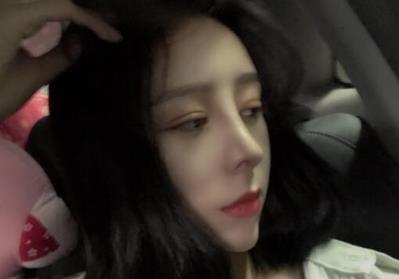双眼皮+隆鼻+下颌角磨骨手术后1个月