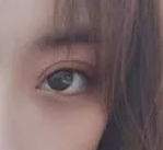 双眼皮