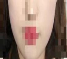 咬肌大