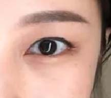 单眼皮