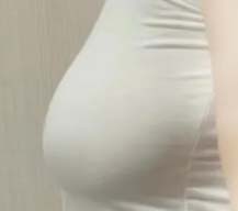 哺乳期过后胸部下垂，一招矫正