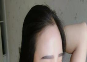 自体脂肪填充手术半个月