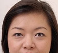 术后效果非常惊喜