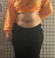 摆脱腰腹赘肉 吸脂塑造曼妙身形