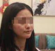 面部吸脂手术大大改善了我的面部美观