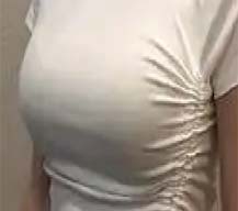 隆胸后穿啥衣服都觉得体态好