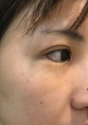 彩光嫩肤让肌肤变得焕然一新
