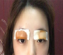 双眼皮的形态很满意