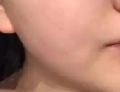 肤色变得暗黄