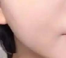春节前注射美白水光，肤色提亮气质提升