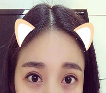 做完双眼皮后 化淡妆都好看
