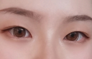 塑造深邃美眼 全切法非常合适