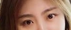 术后60天，我发现眼睛基本上恢复到了比较自然的状态