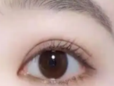 双眼皮割深了怎么办，会不会造成很大的影响