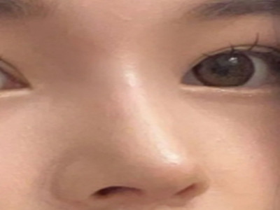 苏州隆鼻名医榜：揭秘那些让人变美的秘密基地