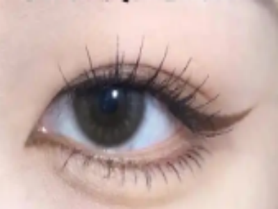开眼角可以解决眼角下垂或者是眼角有皱纹等情况吗