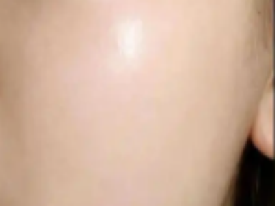 做注射水光后多久可以洗脸？一年要多少次