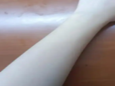 上臂的脂肪吸除过程一般不会造成巨大疼痛