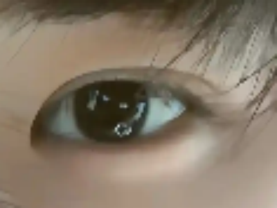 做了双眼皮以后一定会好看吗？不好看的话怎么办呢