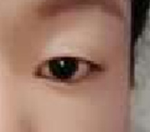 重塑灵动双眸，开启自信新篇