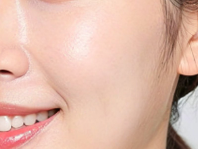 额部填充后洗头指南：时间、护理与疤痕修复热门问答全解析